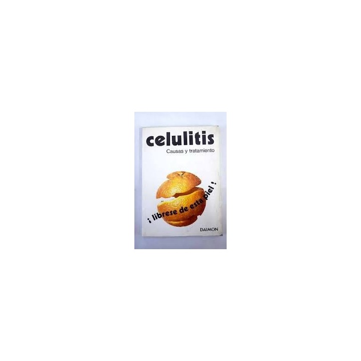Celulitis. Causas y tratamiento.
